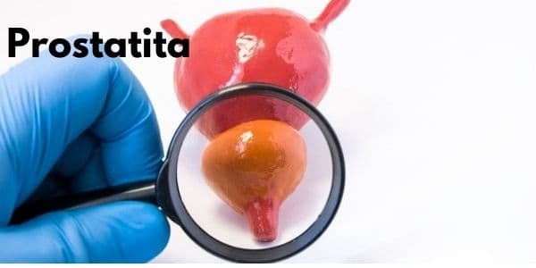 Prostatita (acuta, cronica): cauze, simptome si tratament